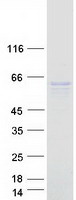 C6orf118 Protein - Purified recombinant protein C6orf118 was analyzed by SDS-PAGE gel and Coomassie Blue Staining