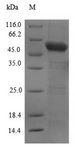 C6orf150 / MB21D1 Protein - (Tris-Glycine gel) Discontinuous SDS-PAGE (reduced) with 5% enrichment gel and 15% separation gel.