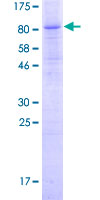 C6orf150 / MB21D1 Protein - 12.5% SDS-PAGE of human MB21D1 stained with Coomassie Blue