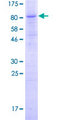 C6orf150 / MB21D1 Protein - 12.5% SDS-PAGE of human MB21D1 stained with Coomassie Blue