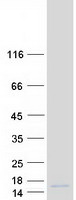 C6orf226 Protein - Purified recombinant protein C6orf226 was analyzed by SDS-PAGE gel and Coomassie Blue Staining