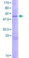 C6orf25 Protein - 12.5% SDS-PAGE of human C6orf25 stained with Coomassie Blue