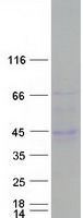 C6orf58 Protein - Purified recombinant protein C6orf58 was analyzed by SDS-PAGE gel and Coomassie Blue Staining