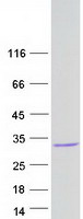 C6orf62 Protein - Purified recombinant protein C6orf62 was analyzed by SDS-PAGE gel and Coomassie Blue Staining