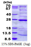 C6orf66 Protein