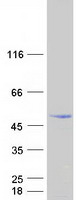 C7orf25 Protein - Purified recombinant protein C7orf25 was analyzed by SDS-PAGE gel and Coomassie Blue Staining