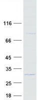 C7orf61 Protein - Purified recombinant protein C7orf61 was analyzed by SDS-PAGE gel and Coomassie Blue Staining