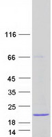 C8orf31 Protein - Purified recombinant protein C8orf31 was analyzed by SDS-PAGE gel and Coomassie Blue Staining