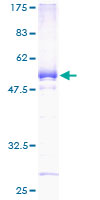 C8orf33 Protein - 12.5% SDS-PAGE of human FLJ20989 stained with Coomassie Blue