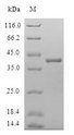 C8orf4 Protein - (Tris-Glycine gel) Discontinuous SDS-PAGE (reduced) with 5% enrichment gel and 15% separation gel.