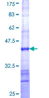 C8orf4 Protein - 12.5% SDS-PAGE Stained with Coomassie Blue.