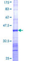 C8orf4 Protein - 12.5% SDS-PAGE Stained with Coomassie Blue.