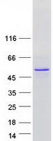 C8orf58 Protein - Purified recombinant protein C8orf58 was analyzed by SDS-PAGE gel and Coomassie Blue Staining