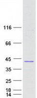 C8orf74 Protein - Purified recombinant protein C8orf74 was analyzed by SDS-PAGE gel and Coomassie Blue Staining