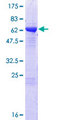 C8orf76 Protein - 12.5% SDS-PAGE of human C8orf76 stained with Coomassie Blue
