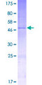C8orf82 Protein - 12.5% SDS-PAGE of human MGC70857 stained with Coomassie Blue