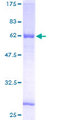 C9orf100 Protein - 12.5% SDS-PAGE of human C9orf100 stained with Coomassie Blue