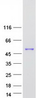 C9orf114 Protein - Purified recombinant protein SPOUT1 was analyzed by SDS-PAGE gel and Coomassie Blue Staining