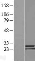 C9orf152 Protein - Western validation with an anti-DDK antibody * L: Control HEK293 lysate R: Over-expression lysate