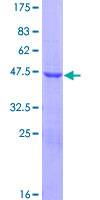 C9orf153 Protein - 12.5% SDS-PAGE of human PACAP stained with Coomassie Blue