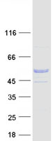 C9orf24 Protein - Purified recombinant protein C9orf24 was analyzed by SDS-PAGE gel and Coomassie Blue Staining