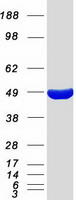 C9orf41 Protein - Purified recombinant protein CARNMT1 was analyzed by SDS-PAGE gel and Coomassie Blue Staining