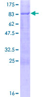 C9orf43 Protein - 12.5% SDS-PAGE of human C9orf43 stained with Coomassie Blue