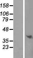 C9orf64 Protein - Western validation with an anti-DDK antibody * L: Control HEK293 lysate R: Over-expression lysate