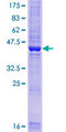C9orf7 Protein - 12.5% SDS-PAGE of human CACFD1 stained with Coomassie Blue