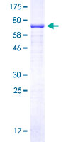 C9orf72 / ALSFTD Protein - 12.5% SDS-PAGE of human C9orf72 stained with Coomassie Blue