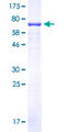 C9orf72 / ALSFTD Protein - 12.5% SDS-PAGE of human C9orf72 stained with Coomassie Blue