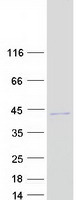C9orf78 Protein - Purified recombinant protein C9orf78 was analyzed by SDS-PAGE gel and Coomassie Blue Staining