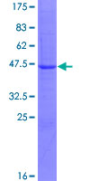 C9orf89 Protein - 12.5% SDS-PAGE of human C9orf89 stained with Coomassie Blue