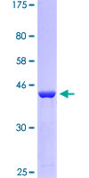C9orf9 Protein - 12.5% SDS-PAGE of human C9orf9 stained with Coomassie Blue