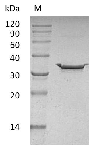 CA-VB / CA5B Protein - (Tris-Glycine gel) Discontinuous SDS-PAGE (reduced) with 5% enrichment gel and 15% separation gel.