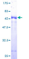 CA-VB / CA5B Protein - 12.5% SDS-PAGE of human CA5B stained with Coomassie Blue