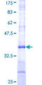 CA-VB / CA5B Protein - 12.5% SDS-PAGE Stained with Coomassie Blue.