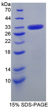 CA-VB / CA5B Protein - Recombinant Carbonic Anhydrase VB, Mitochondrial By SDS-PAGE