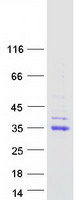 CA-VB / CA5B Protein - Purified recombinant protein CA5B was analyzed by SDS-PAGE gel and Coomassie Blue Staining