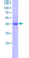 CA1 / Carbonic Anhydrase I Protein - 12.5% SDS-PAGE Stained with Coomassie Blue.