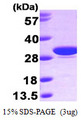 CA1 / Carbonic Anhydrase I Protein