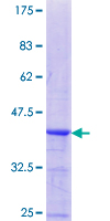 CA10 / Carbonic Andhydrase X Protein - 12.5% SDS-PAGE Stained with Coomassie Blue.