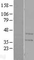 CA11 / Carbonic Anhydrase XI Protein - Western validation with an anti-DDK antibody * L: Control HEK293 lysate R: Over-expression lysate
