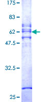 CA11 / Carbonic Anhydrase XI Protein - 12.5% SDS-PAGE of human CA11 stained with Coomassie Blue