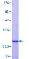 CA11 / Carbonic Anhydrase XI Protein - 12.5% SDS-PAGE Stained with Coomassie Blue.