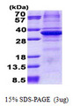 CA11 / Carbonic Anhydrase XI Protein