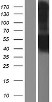 CA12 / Carbonic Anhydrase XII Protein - Western validation with an anti-DDK antibody * L: Control HEK293 lysate R: Over-expression lysate