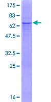 CA12 / Carbonic Anhydrase XII Protein - 12.5% SDS-PAGE of human CA12 stained with Coomassie Blue