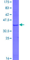 CA12 / Carbonic Anhydrase XII Protein - 12.5% SDS-PAGE Stained with Coomassie Blue.