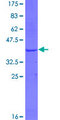 CA12 / Carbonic Anhydrase XII Protein - 12.5% SDS-PAGE Stained with Coomassie Blue.